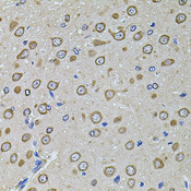 EIF4A2 Antibody - Immunohistochemistry of paraffin-embedded rat brain tissue.