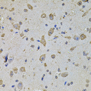 EIF4A2 Antibody - Immunohistochemistry of paraffin-embedded mouse brain tissue.