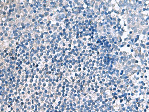 EIF4A2 Antibody - Immunohistochemistry of paraffin-embedded Human tonsil tissue  using EIF4A2 Polyclonal Antibody at dilution of 1:70(×200)
