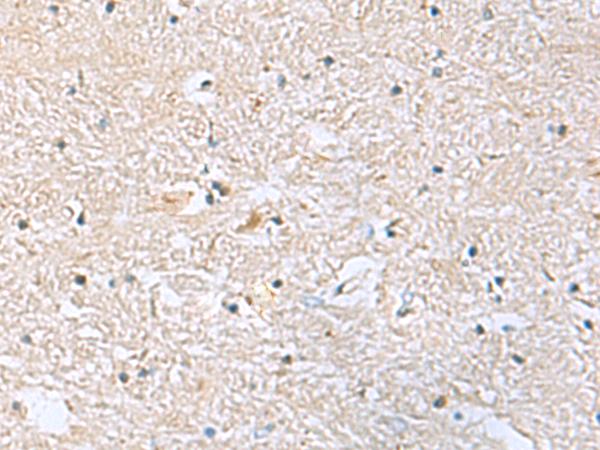 EIF4A2 Antibody - Immunohistochemistry of paraffin-embedded Human brain tissue  using EIF4A2 Polyclonal Antibody at dilution of 1:70(×200)