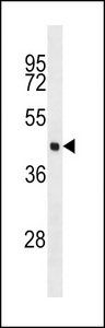 EIF4A3 Antibody - EIF4A3 Antibody western blot of MCF-7 cell line lysates (35 ug/lane). The EIF4A3 antibody detected the EIF4A3 protein (arrow).