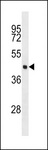 EIF4A3 Antibody - EIF4A3 Antibody western blot of MCF-7 cell line lysates (35 ug/lane). The EIF4A3 antibody detected the EIF4A3 protein (arrow).