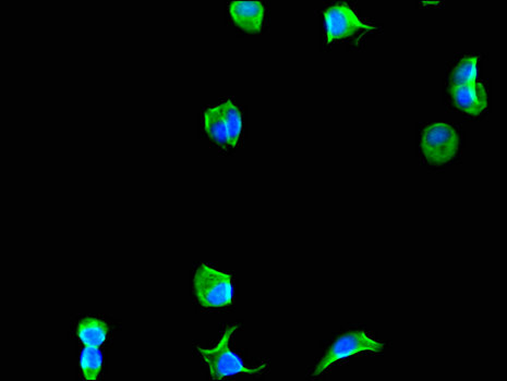 EIF4A3 Antibody - Immunofluorescent analysis of MCF-7 cells using EIF4A3 Antibody at a dilution of 1:100 and Alexa Fluor 488-congugated AffiniPure Goat Anti-Rabbit IgG(H+L)