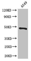 EIF4A3 Antibody - Western Blot Positive WB detected in: A549 whole cell lysate All lanes: EIF4A3 antibody at 3µg/ml Secondary Goat polyclonal to rabbit IgG at 1/50000 dilution Predicted band size: 47 kDa Observed band size: 47 kDa