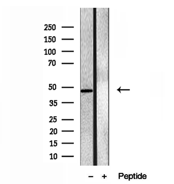 EIF4A3 Antibody - Western blot analysis of extracts of A549 cells using EIF4A3 antibody.