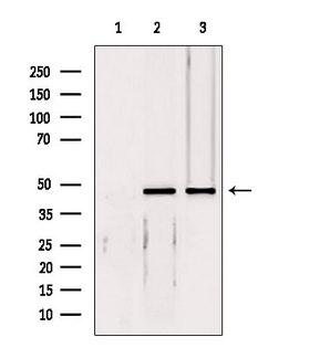 EIF4A3 Antibody - Western blot analysis of extracts of various samples using EIF4A3 antibody. Lane 1: HepG2 treated with blocking peptide. Lane 2: HepG2; Lane 3: 293;