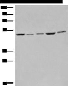 EIF4A3 Antibody - Western blot analysis of Raji Hela A549 HEPG2 and 231 cell lysates  using EIF4A3 Polyclonal Antibody at dilution of 1:500