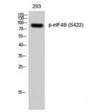 EIF4B Antibody - Western blot of Phospho-eIF4B (S422) antibody