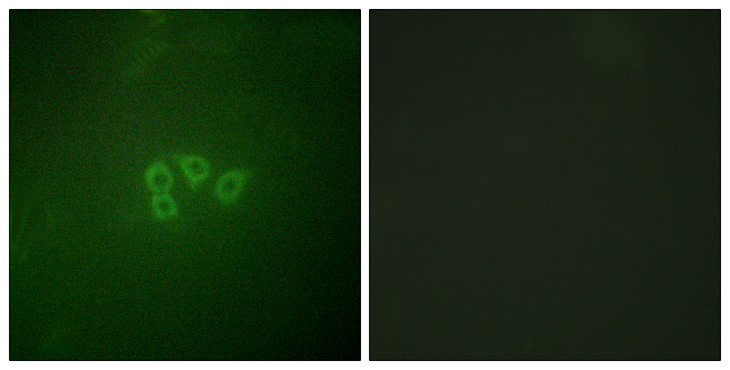 EIF4B Antibody - Immunofluorescence analysis of A549 cells, using eIF4B Antibody. The picture on the right is blocked with the synthesized peptide.