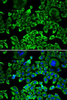 EIF4B Antibody - Immunofluorescence analysis of A549 cells.