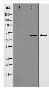 EIF4B Antibody - Western blot of eIF4B expression in HepG2 cells