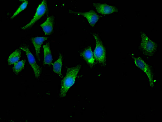 EIF4B Antibody - Immunofluorescent analysis of Hela cells using EIF4B Antibody at a dilution of 1:100 and Alexa Fluor 488-congugated AffiniPure Goat Anti-Rabbit IgG(H+L)