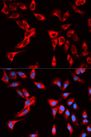 EIF4B Antibody - Immunofluorescence analysis of U2OS cells using EIF4B antibody. Blue: DAPI for nuclear staining.