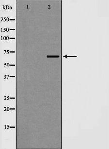 EIF4B Antibody - Western blot analysis of eIF4B expression in HepG2 cells. The lane on the left is treated with the antigen-specific peptide.