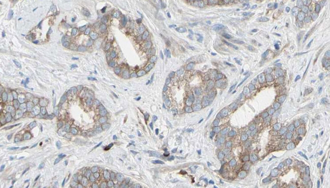 EIF4B Antibody - 1:100 staining human prostate tissue by IHC-P. The sample was formaldehyde fixed and a heat mediated antigen retrieval step in citrate buffer was performed. The sample was then blocked and incubated with the antibody for 1.5 hours at 22°C. An HRP conjugated goat anti-rabbit antibody was used as the secondary.