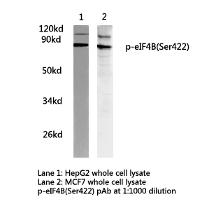 EIF4B Antibody - Western blot of p-eIF4B(Ser422) pAb in extracts from HepG2, MCF7 cells and RAW264.7 cells.