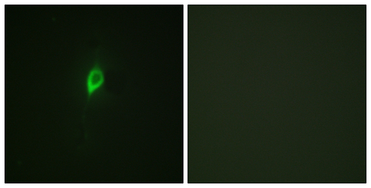 EIF4B Antibody - Immunofluorescence analysis of NIH/3T3 cells, using eIF4B (Phospho-Ser422) Antibody. The picture on the right is blocked with the phospho peptide.