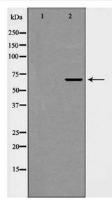EIF4B Antibody - Western blot of eIF4B (Phospho-Ser422) expression in HepG2 cells