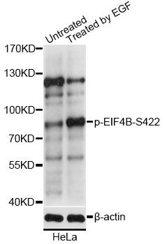 EIF4B Antibody - Western blot analysis of extracts of HeLa cells, using Phospho-EIF4B-S422 antibody at 1:2000 dilution. HeLa cells were treated by EGF (100ng/ml) for 30 minutes after serum-starvation overnight. The secondary antibody used was an HRP Goat Anti-Rabbit IgG (H+L) at 1:10000 dilution. Lysates were loaded 25ug per lane and 3% nonfat dry milk in TBST was used for blocking. Blocking buffer: 3% BSA.An ECL Kit was used for detection and the exposure time was 60s.