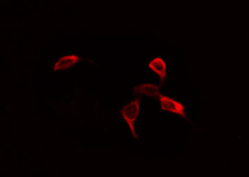 EIF4B Antibody - Staining NIH-3T3 cells by IF/ICC. The samples were fixed with PFA and permeabilized in 0.1% Triton X-100, then blocked in 10% serum for 45 min at 25°C. The primary antibody was diluted at 1:200 and incubated with the sample for 1 hour at 37°C. An Alexa Fluor 594 conjugated goat anti-rabbit IgG (H+L) Ab, diluted at 1/600, was used as the secondary antibody.