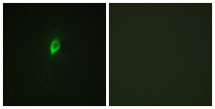 EIF4B Antibody - P-peptide - + Immunofluorescence analysis of NIH/3T3 cells, using eIF4B (Phospho-Ser422) antibody.