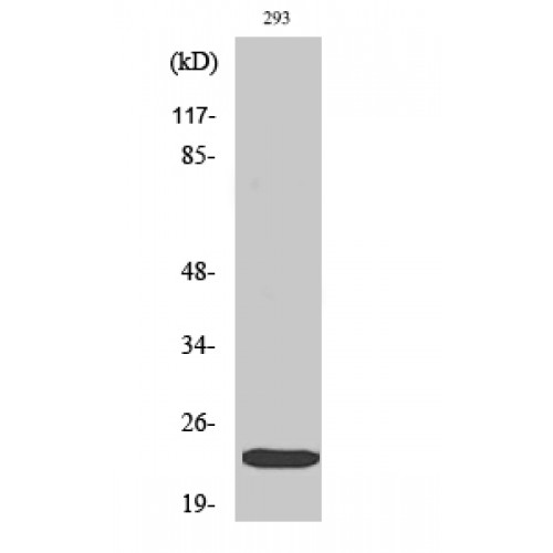 EIF4E Antibody - Western blot of Phospho-eIF4E (S209) antibody