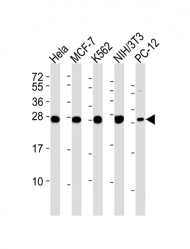 EIF4E Antibody - All lanes : Anti-IF4E Antibody at 1:4000 dilution Lane 1: HeLa whole cell lysates Lane 2: MCF-7 whole cell lysates Lane 3: K562 whole cell lysates Lane 4: NIH/3T3 whole cell lysates Lane 5: PC-12 whole cell lysates Lysates/proteins at 20 ug per lane. Secondary Goat Anti-Rabbit IgG, (H+L), Peroxidase conjugated at 1/10000 dilution Predicted band size : 25 kDa Blocking/Dilution buffer: 5% NFDM/TBST.