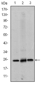 EIF4E Antibody - Western blot using EIF4E mouse monoclonal antibody against HeLa (1), HEK293 (2) and K562 (3) cell lysate.