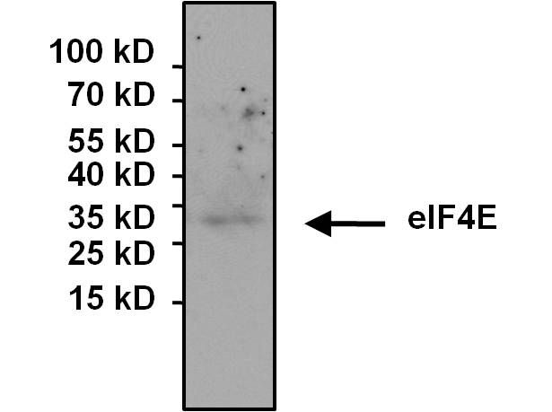 EIF4E Antibody - eIF4E Antibody in Immunoprecipitation (IP)