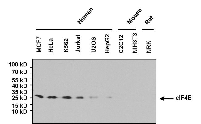 EIF4E Antibody - eIF4E Antibody in Western Blot (WB)