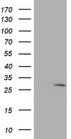 EIF4E Antibody - HEK293T cells were transfected with the pCMV6-ENTRY control (Left lane) or pCMV6-ENTRY EIF4E (Right lane) cDNA for 48 hrs and lysed. Equivalent amounts of cell lysates (5 ug per lane) were separated by SDS-PAGE and immunoblotted with anti-EIF4E.