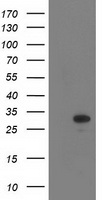 EIF4E Antibody - HEK293T cells were transfected with the pCMV6-ENTRY control (Left lane) or pCMV6-ENTRY EIF4E (Right lane) cDNA for 48 hrs and lysed. Equivalent amounts of cell lysates (5 ug per lane) were separated by SDS-PAGE and immunoblotted with anti-EIF4E.