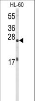EIF4E Antibody - Western blot of EIF4E Antibody in HL-60 cell line lysates (35 ug/lane). EIF4E (arrow) was detected using the purified antibody.