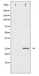 EIF4E Antibody - Western blot of eIF4E expression in FBS treated NIH-3T3 whole cell lysates,The lane on the left is treated with the antigen-specific peptide.