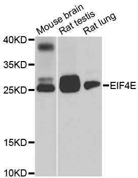 EIF4E Antibody - Western blot analysis of extracts of various cell lines, using EIF4E antibody at 1:1000 dilution. The secondary antibody used was an HRP Goat Anti-Rabbit IgG (H+L) at 1:10000 dilution. Lysates were loaded 25ug per lane and 3% nonfat dry milk in TBST was used for blocking. An ECL Kit was used for detection and the exposure time was 10s.