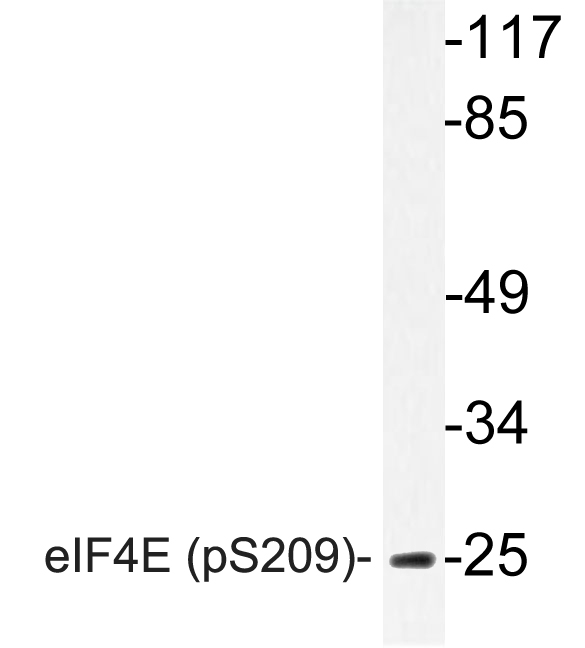 EIF4E Antibody - Western blot of p-eIF4E (S209) pAb in extracts from 293 Anisomycin cells.