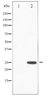 EIF4E Antibody - Western blot of eIF4E phosphorylation expression in FBS treated NIH-3T3 whole cell lysates,The lane on the left is treated with the antigen-specific peptide.