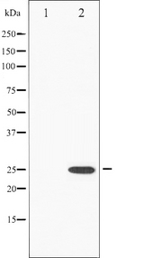 EIF4E Antibody - Western blot analysis of eIF4E phosphorylation expression in FBS treated NIH-3T3 whole cells lysates. The lane on the left is treated with the antigen-specific peptide.