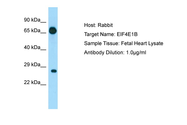 EIF4E1B Antibody -  This image was taken for the unconjugated form of this product. Other forms have not been tested.