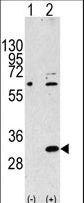 EIF4E2 / IF4e Antibody - Western blot of EIF4E2 Antibody polyclonal antibody(arrow). 293 cell lysates (2 ug/lane) either nontransfected (Lane 1) or transiently transfected with the EIF4E2 gene (Lane 2) (Origene Technologies).