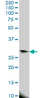 EIF4E2 / IF4e Antibody - EIF4E2 monoclonal antibody (M01), clone 4G10 Western blot of EIF4E2 expression in HeLa.