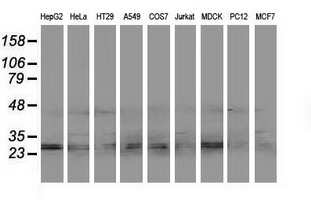 EIF4E2 / IF4e Antibody - Western blot of extracts (35ug) from 9 different cell lines by using anti-EIF4E2 monoclonal antibody.