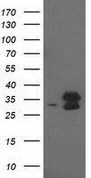 EIF4E2 / IF4e Antibody - HEK293T cells were transfected with the pCMV6-ENTRY control (Left lane) or pCMV6-ENTRY EIF4E2 (Right lane) cDNA for 48 hrs and lysed. Equivalent amounts of cell lysates (5 ug per lane) were separated by SDS-PAGE and immunoblotted with anti-EIF4E2.