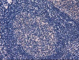 EIF4E2 / IF4e Antibody - IHC of paraffin-embedded Human lymph node tissue using anti-EIF4E2 mouse monoclonal antibody.