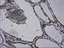 EIF4E2 / IF4e Antibody - IHC of paraffin-embedded Human thyroid tissue using anti-EIF4E2 mouse monoclonal antibody.