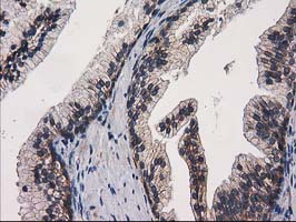 EIF4E2 / IF4e Antibody - IHC of paraffin-embedded Human prostate tissue using anti-EIF4E2 mouse monoclonal antibody.