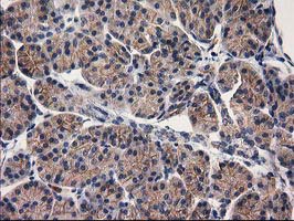 EIF4E2 / IF4e Antibody - IHC of paraffin-embedded Human pancreas tissue using anti-EIF4E2 mouse monoclonal antibody. (Heat-induced epitope retrieval by 10mM citric buffer, pH6.0, 100C for 10min).