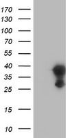EIF4E2 / IF4e Antibody - HEK293T cells were transfected with the pCMV6-ENTRY control (Left lane) or pCMV6-ENTRY EIF4E2 (Right lane) cDNA for 48 hrs and lysed. Equivalent amounts of cell lysates (5 ug per lane) were separated by SDS-PAGE and immunoblotted with anti-EIF4E2.