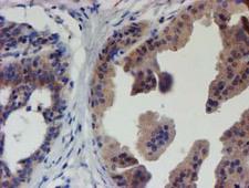 EIF4E2 / IF4e Antibody - IHC of paraffin-embedded Human breast tissue using anti-EIF4E2 mouse monoclonal antibody.