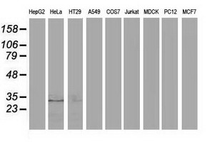EIF4E2 / IF4e Antibody - Western blot of extracts (35 ug) from 9 different cell lines by using anti-EIF4E2 monoclonal antibody.